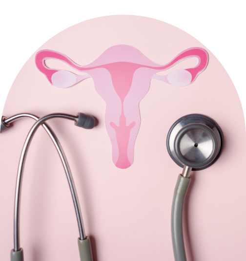 Polycystic ovary syndrome (PCOS) Functional medicine